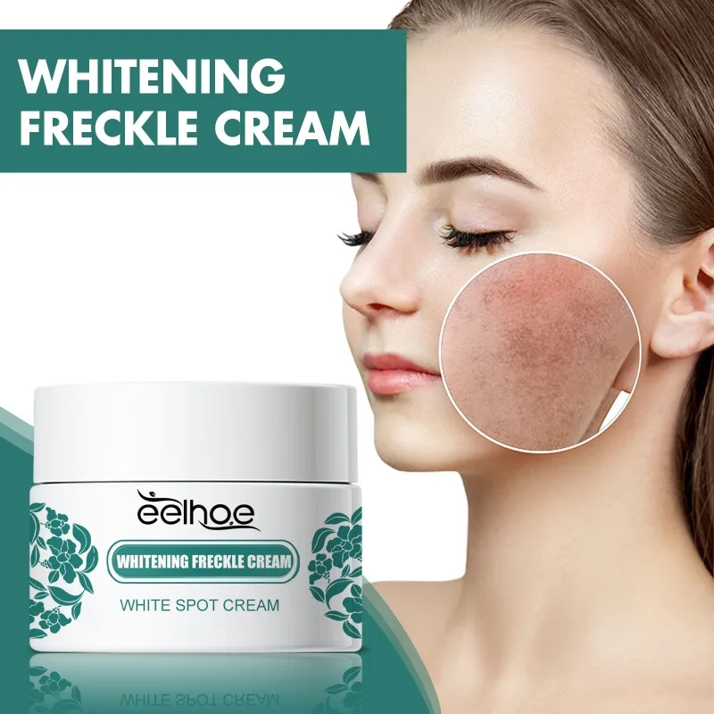 Whitening Freckles Cream Removal Melasma Melanin Anti-aging Brighten Face Dark Spots Remover Repair Moisturiz Care Products