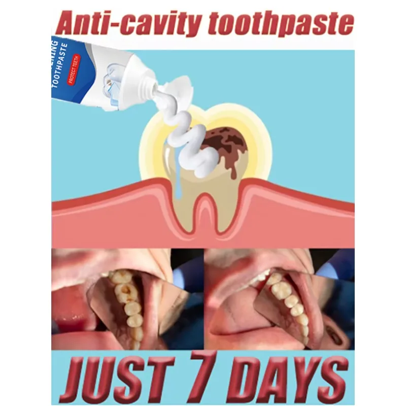 2nd Generation Upgraded Tooth Repair Tooth Root Quickly