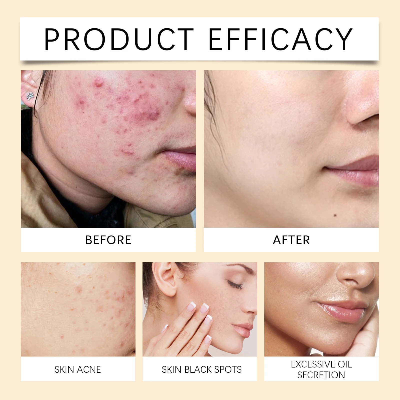 وسادة تنظيف حمض الكركم الكوجيك تزيل تقشير بطف ينظف البشرة بعمق ويفتيح البقع ويحافظ على العناية بالوجه