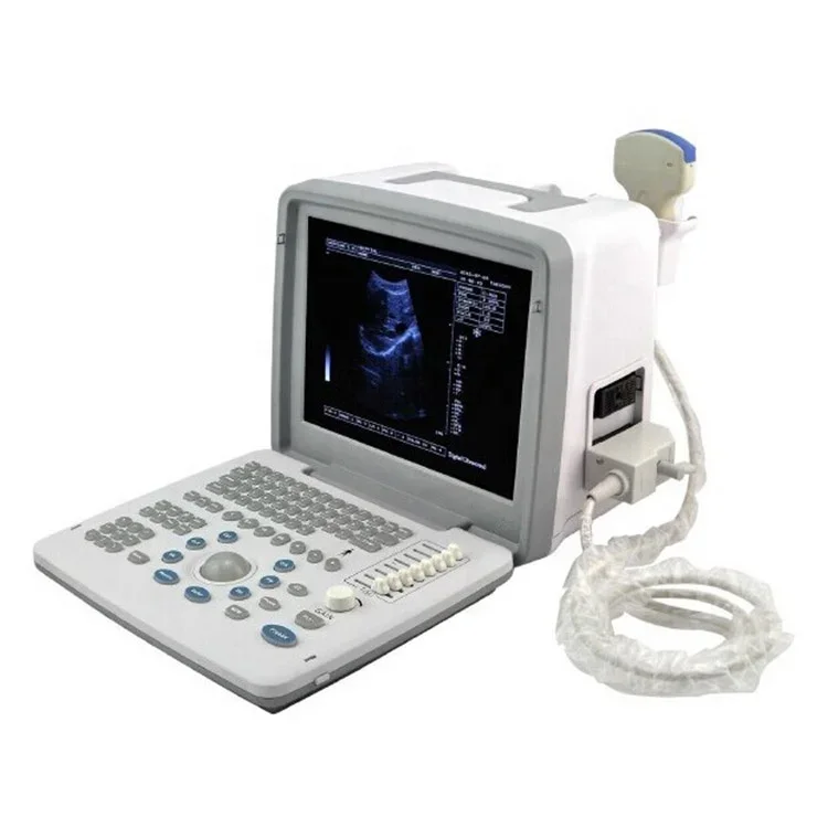 

UBW300 Medical Diagnosis Equipment Black and White Ultrasound Scanner Device for Sale