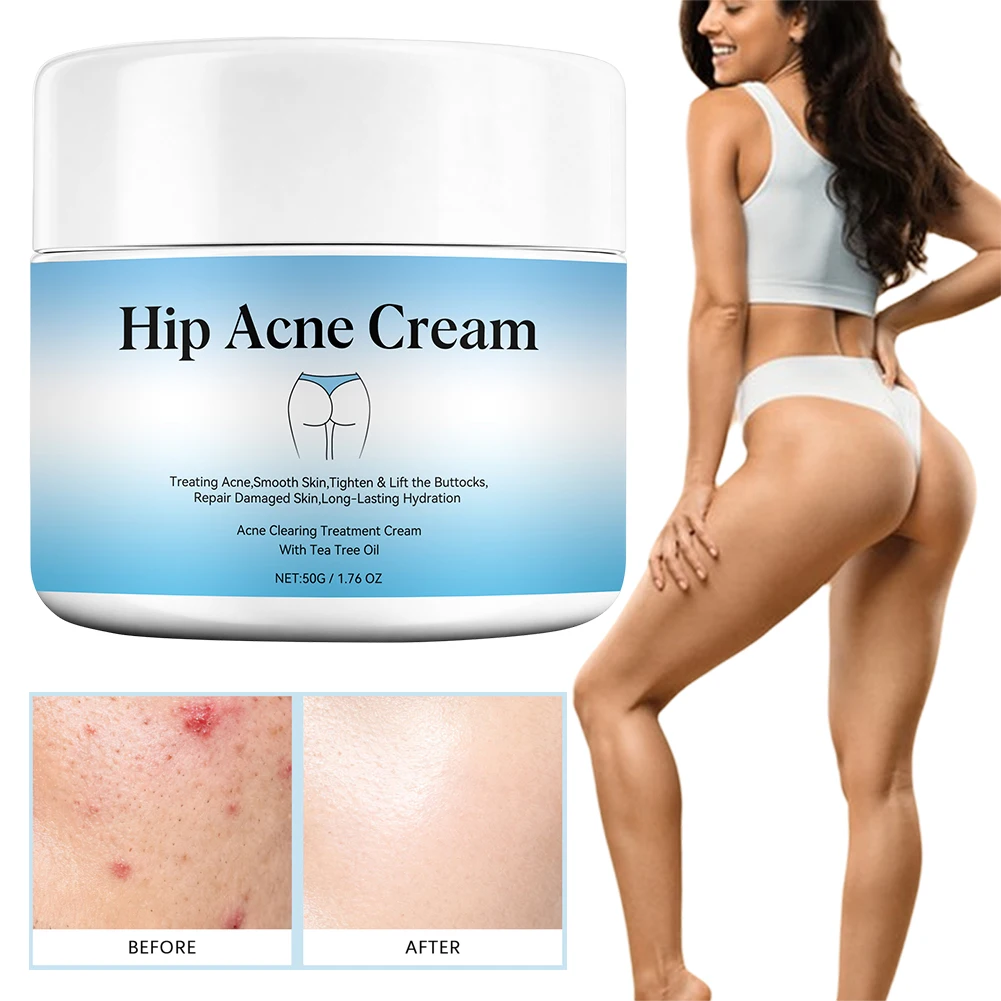Butt Acnes Cream Keep Buttocks Skin Delicate Smoothing Soothes Calms Irritated Skin Exfoliates Fast-Acting Formulas For Women