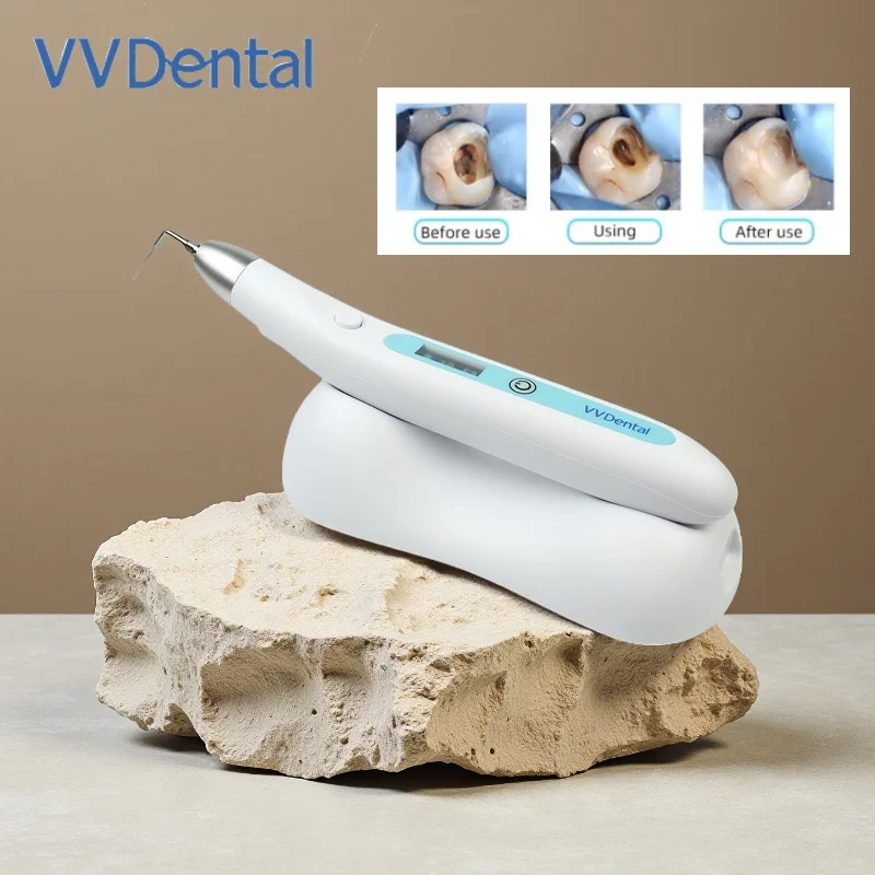 Dental Wireless End…