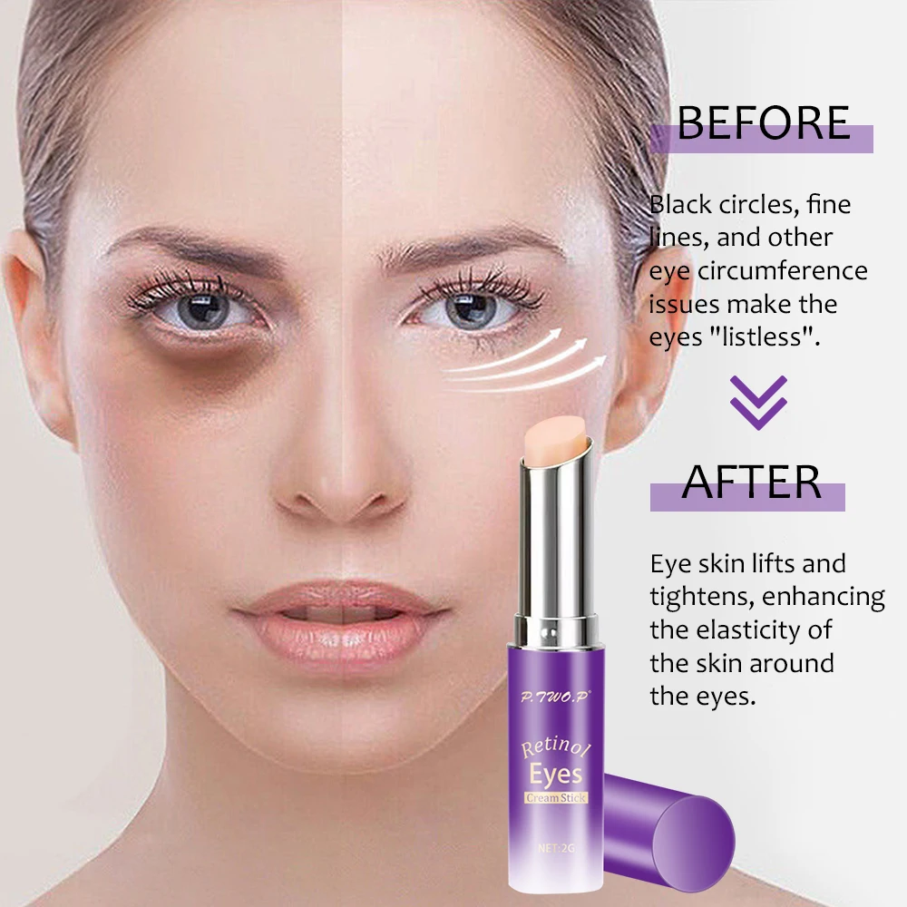 Ptowp Retinol Eye Cream Stick Moisturizing Fade Fine Line Dark Circles Nourish And Moisturize Relieve Eye Fatigue Eye Care