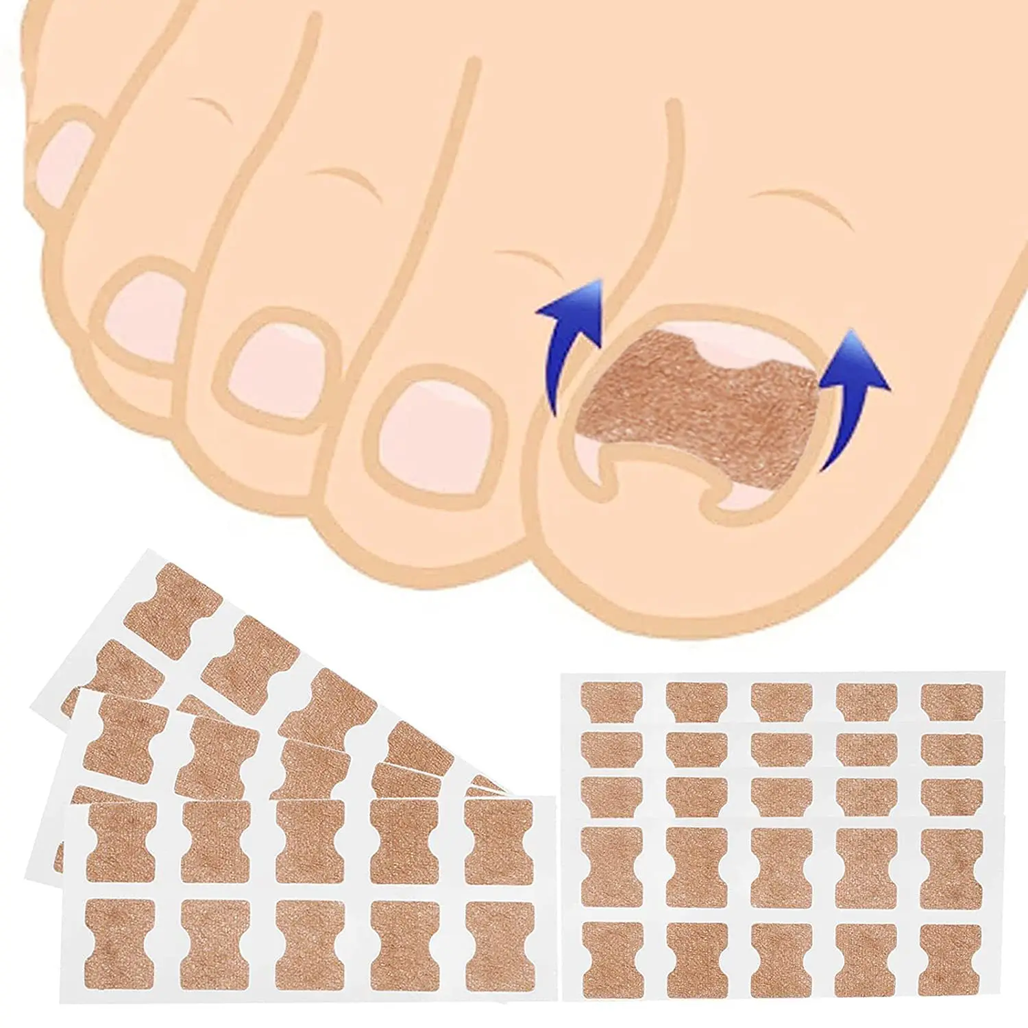 Korrektor für eingewachsene Zehennägel, Glättungsclip, Pediküre-Fußnagelpflege-Werkzeuge, Edelstahl-Pediküre-Behandlung, Onyxis-Korrektur – Detail 3