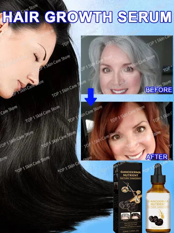 

Gray White Hair Treatment Serum Liquid White To Black Natural Color Repair Nourish Product Anti Loss Hair Care Men Women