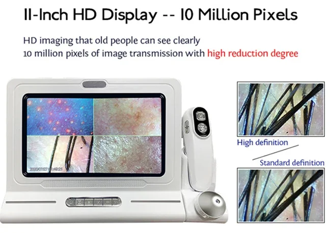 고품질 HD 3D 휴대용 두피 스캐너 감지기 3D 헤어 분석기 기계 IT 얼굴 두피 분석 바디 눈 코 EU ZA