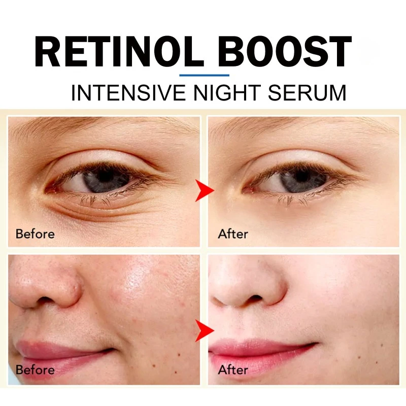 Retinol Anti Aging Essence moisturizing Lift firming Wrinkle remove Fade Dark spots fine lines brighten face skin care Serum