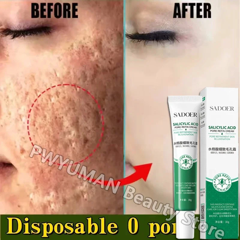 

Pore Shrinking Cream Acne Pit Repair Product for Men Women Remove Acne Print Scar Large Pore Anti-inflammatory Smooth Skin Cream