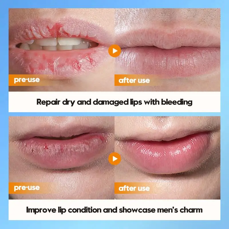 Bálsamo labial SADOER 2.7g para hombre con extracto de hierba de tiburón y vaselina para otoño e invierno, para mejorar la sequedad, hidratar y humectar los labios.