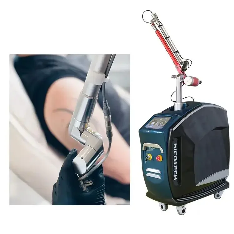 picolaser carbon laser peeling q switched nd yag picosecond laser tattoo removal beauty machine