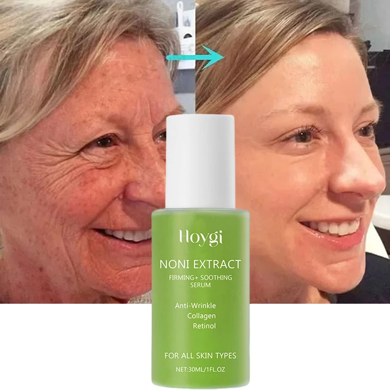 Noni Fruit Face Serum Nourish Noni Extract Essence Korean Anti-wrinkle Moisturizing Fade Fine Lines Energy Ampoule For Skincare