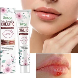 Lip repair balm lightens lip lines Cold Sores Lips Cheilitis treatment cream lip particles anti-Cracking moisturizing care oil