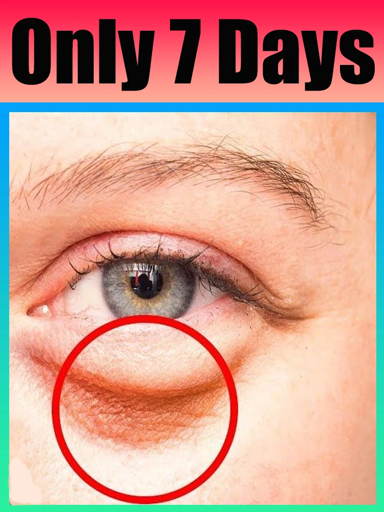 Augenpflege-Tools, 2025, heiß verkaufte Pflege für die Augenpartie, die weitere Flaschen Sie kaufen, der besser mit dem Rabatt