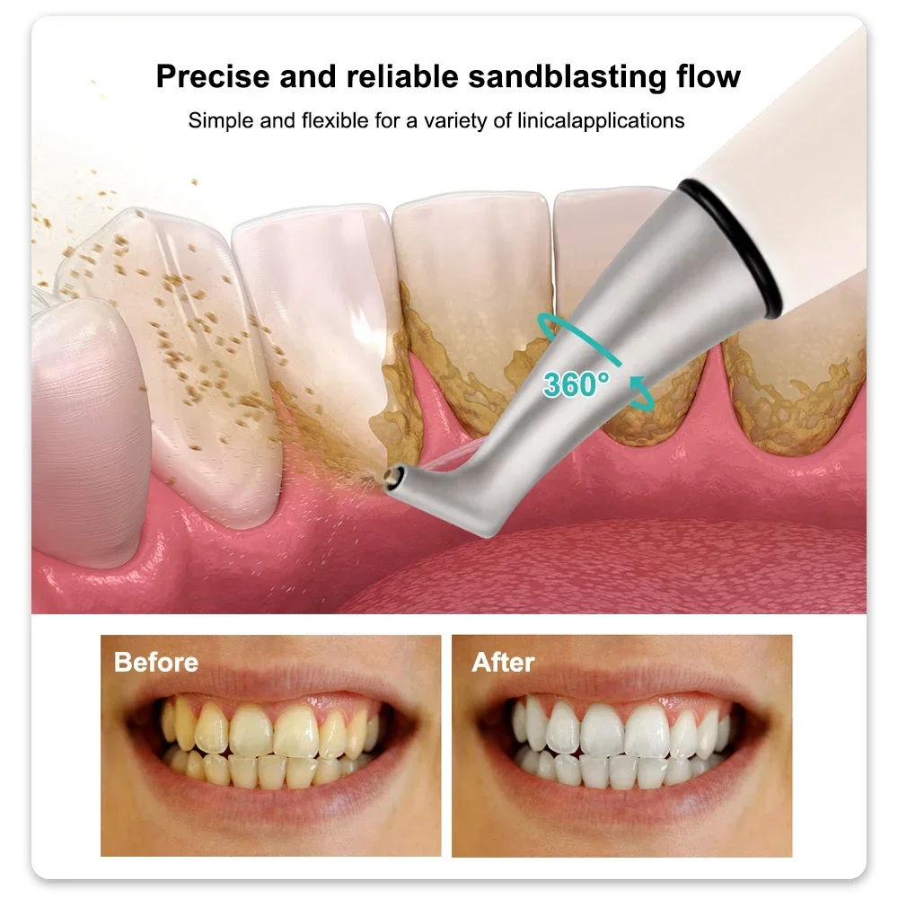 ชุดขัดฟันด้วยทราย SYJH Dental Sandblasting Polishing Unit Air Flow Prophy Jet Handpiece พร้อมสเปรย์ฟอกสีฟัน เครื่องมือทันตกรรมสำหรับขัดฟัน
