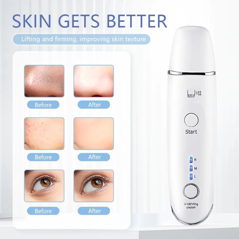 جهاز رادار Hifu لشد البشرة ، نحت الخط ، شد الوجه على شكل حرف V ، إزالة التجاعيد العالية ، آلة التجميل ، تجديد البشرة #4