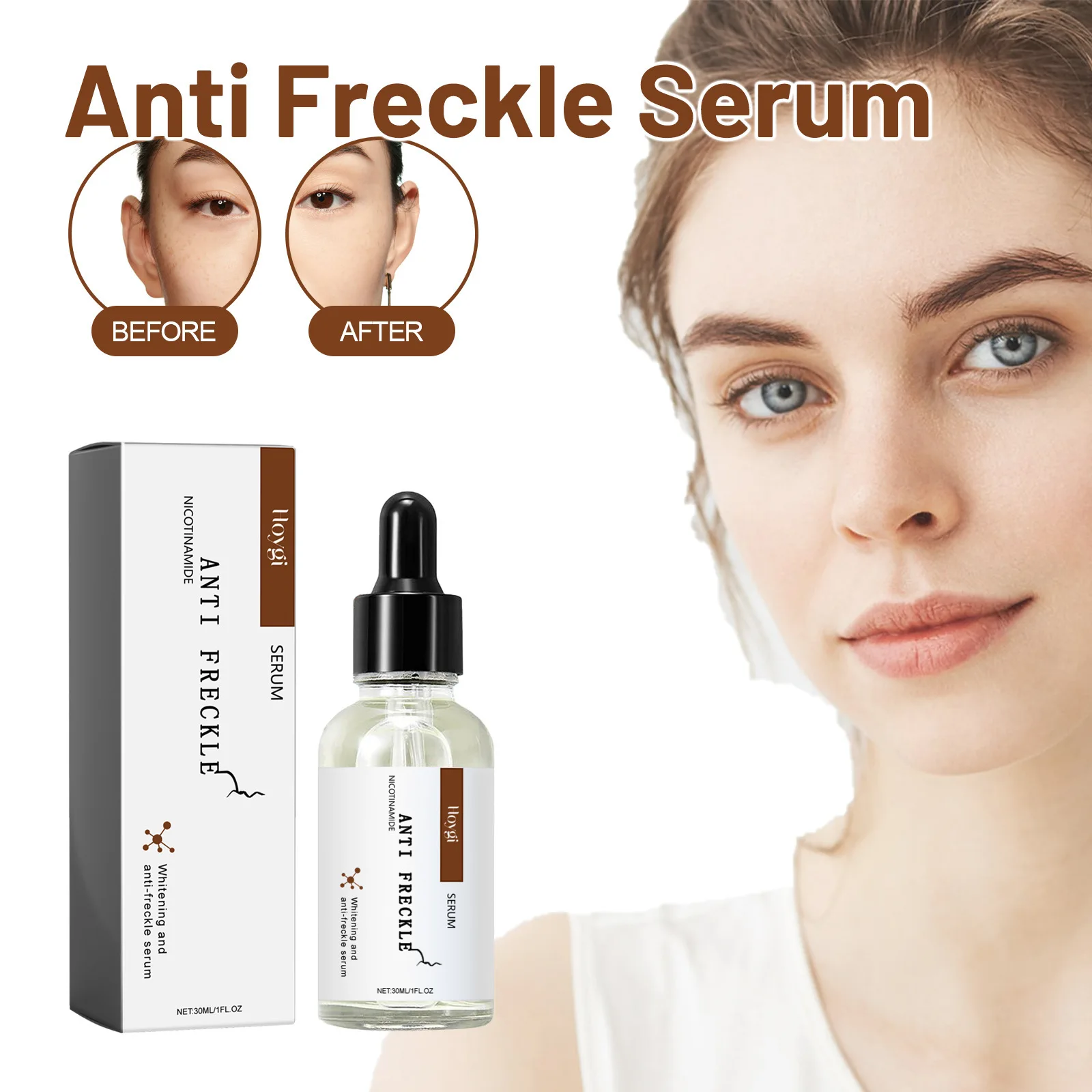 Whitening Freckle Serum Dark Spots Remover Lightening Melasma Melanin Fade Pigmentation Brighten Hydrating Nicotinamide Essence