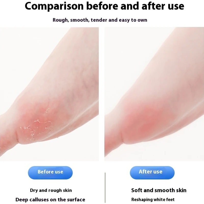 قابلة للشحن الكهربائية القدم طاحونة مزيل الجلد الميت النسيج قدم الغسيل ملف القدم الكهربائية الجافة الميت متصدع العناية بالقدم إصلاح