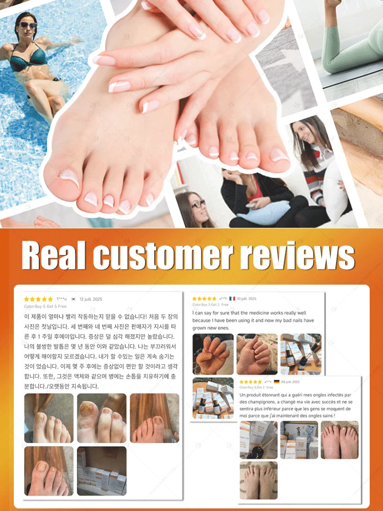 Blue laser care manicure