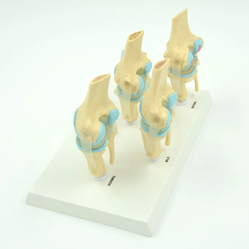 Flexible Human Knee Joint Anatomy Model Comparison of Knee Joint Model Scientific Life Size for