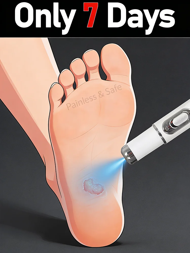 New 2-in-1 blue light pen to solve body warts, skin tag remover,suitable for use on the face, neck,hands and  feet .