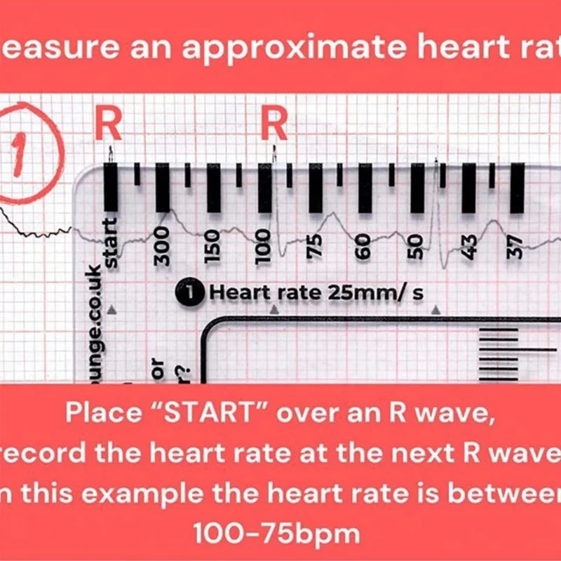 ECG 7 Step Ruler ECG Ruler Plastic Ruler Measuring Tool For ECG/EKG Interpretation Easy-To-Carry With 1 Protect Sheath