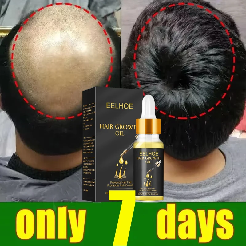 

7-дневная сыворотка для роста волос с имбирным маслом, средства против выпадения волос, восстановление поврежденных корней волос, уход за волосами для женщин и мужчин