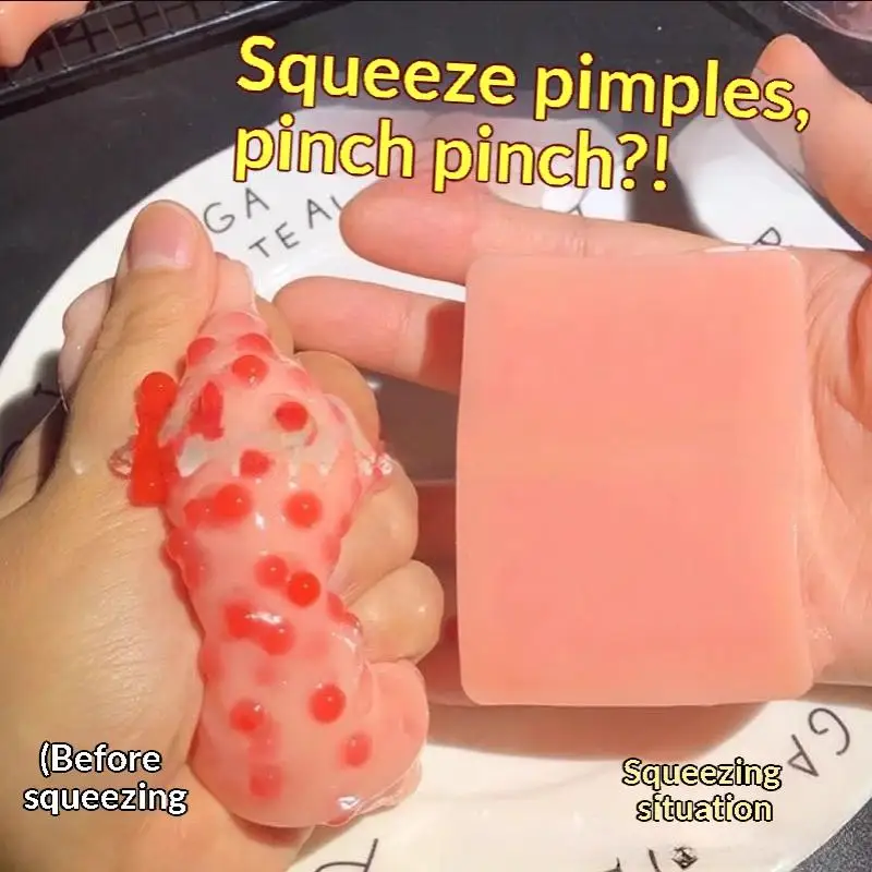 2pcs  Texture Pimple Popping Squeeze Toy Sensory Design Reusable Toy Super Soft Fidget Relieve Anxiety Toy