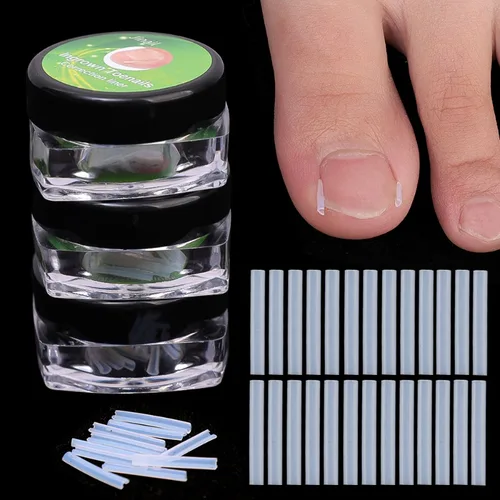 Imagen 2 del producto 10-100 Uds. Corrector de uñas encarnadas, tubo Invisible, parches elásticos para dedos de los pies, Clip alisador, tratamiento de uñas de los pies, pedicura
