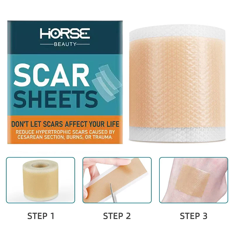 Silicone Gel Scar Remendo Remoção, Folha Cicatriz, Fita Reparação Da Pele, Acne Trauma, Queimar Capa Cicatriz, 150cm