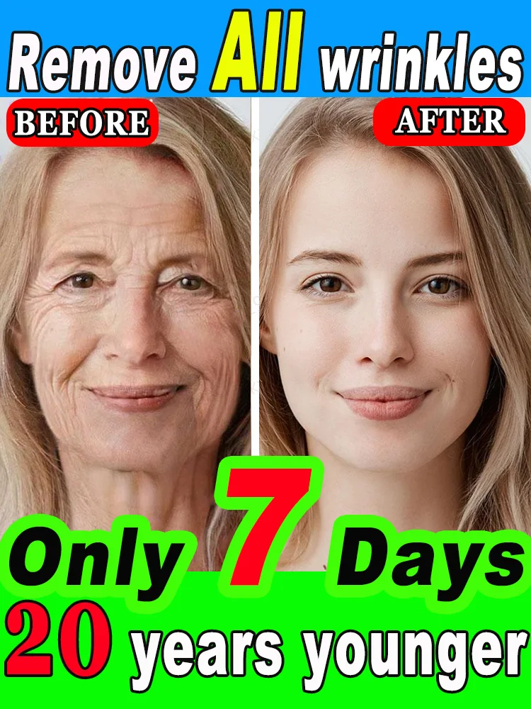 

Wrinkles disappear