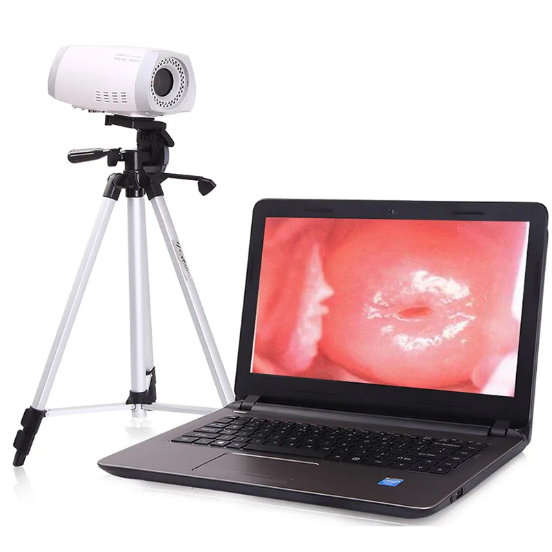 New Optical Video Colpos-cope Medical Device with Laptop Metal and Plastic Electric Power Source