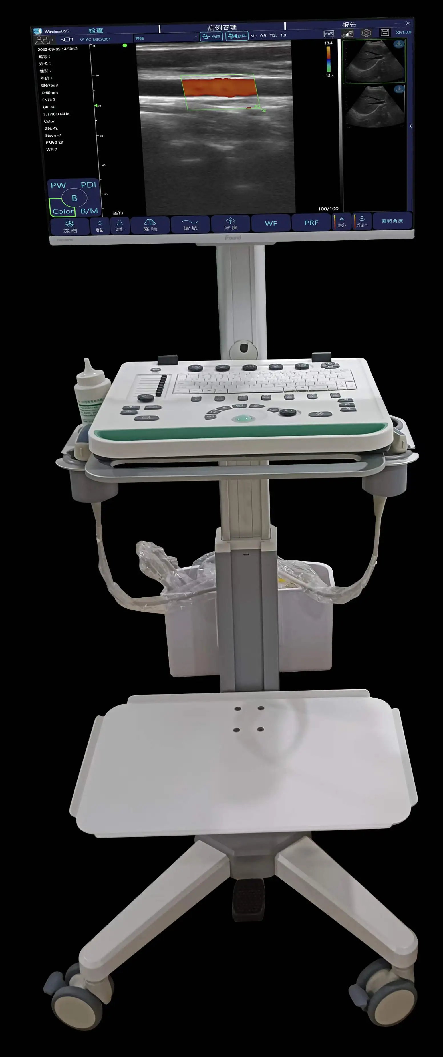 Factory directly sell Trolley Type Ultrasound Machine Doppler Medical Ultrasound System