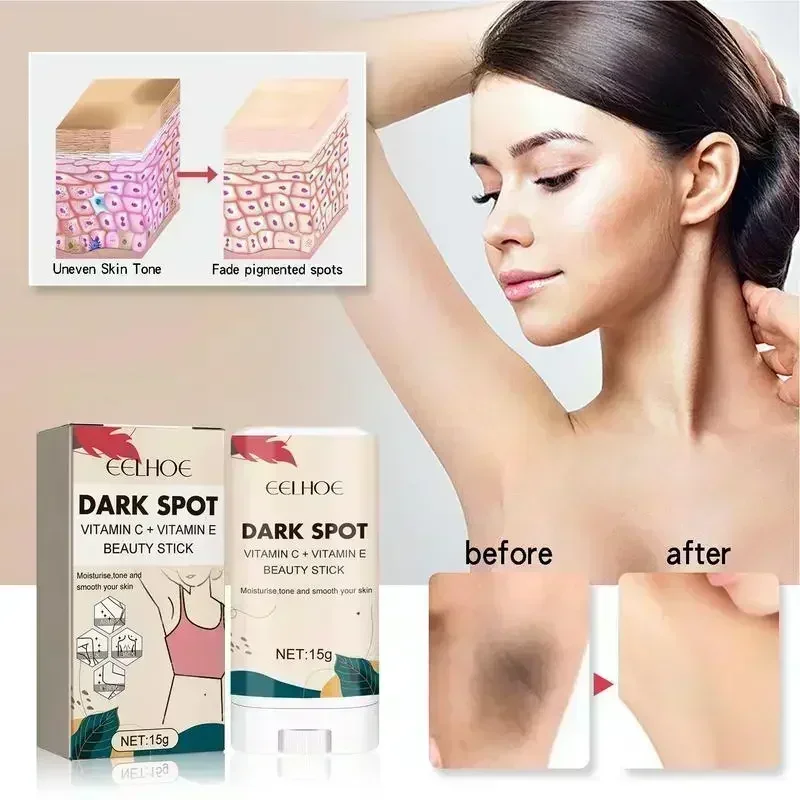 Body Whitening Cream Private Parts Underarm Bleaching Serum Whiten Butt Knee Brighten Inner Thigh Intimate Cream