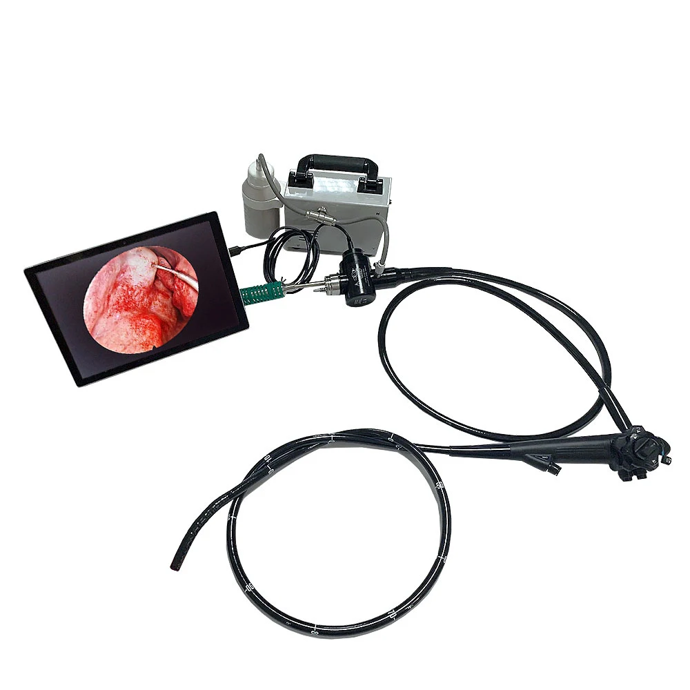LTEG21 Portable Fiberoptic Electronic USB Video Gastroscope Medical Endoscope for Human