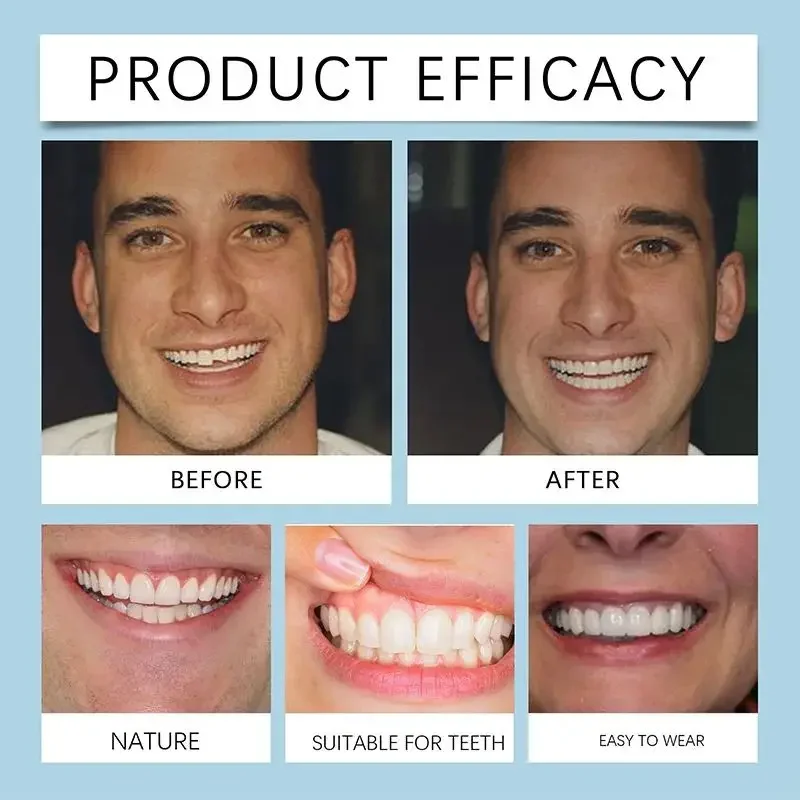 Kit in silicone Protesi Fodere in silicone Kit per protesi morbida Kit per protesi morbida Denti Set superiore e inferiore Facile da usare Cura dei denti