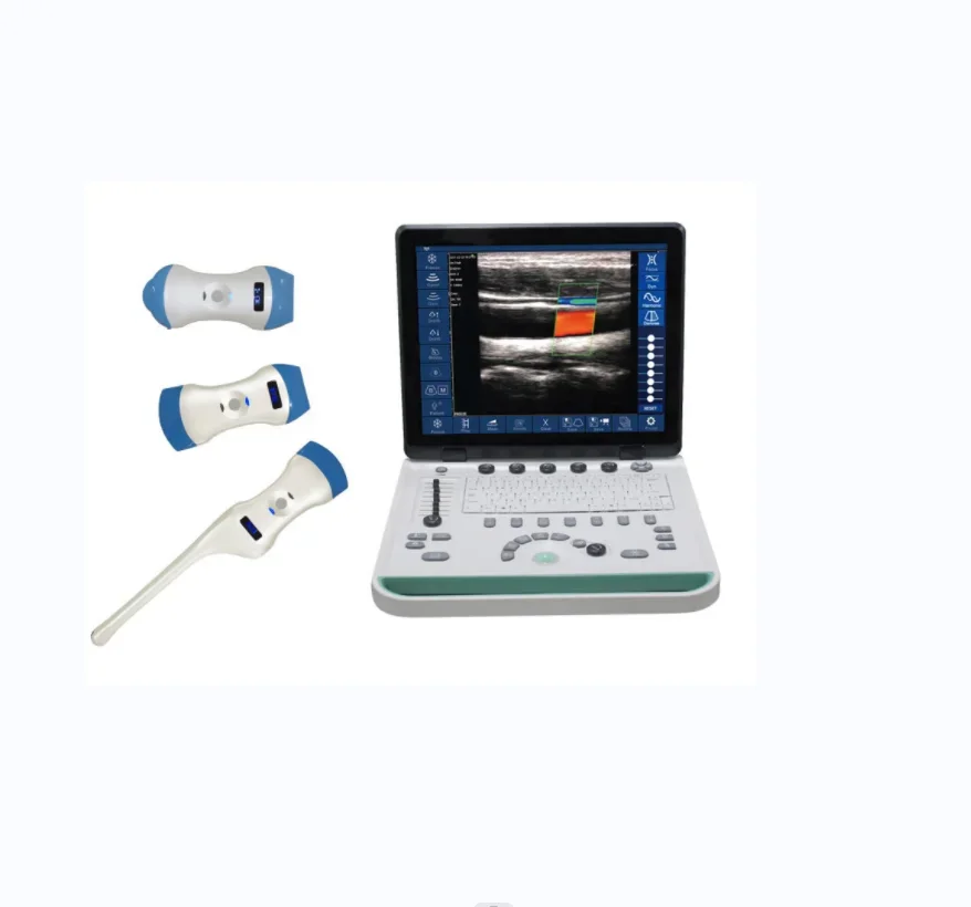 Wifi connection of color Doppler ultrasound system