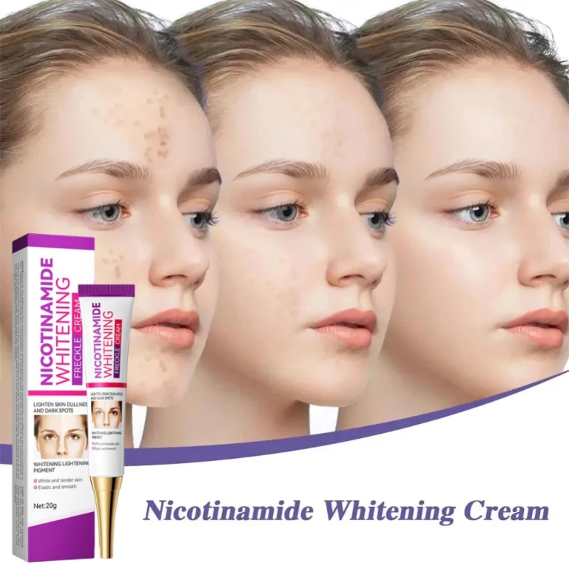 

Lightening Freckles Face Cream Removal Melasma Dark Spots Corrector Lighten Melanin Pigmentation Brighten Anti-Aging Beauty Care