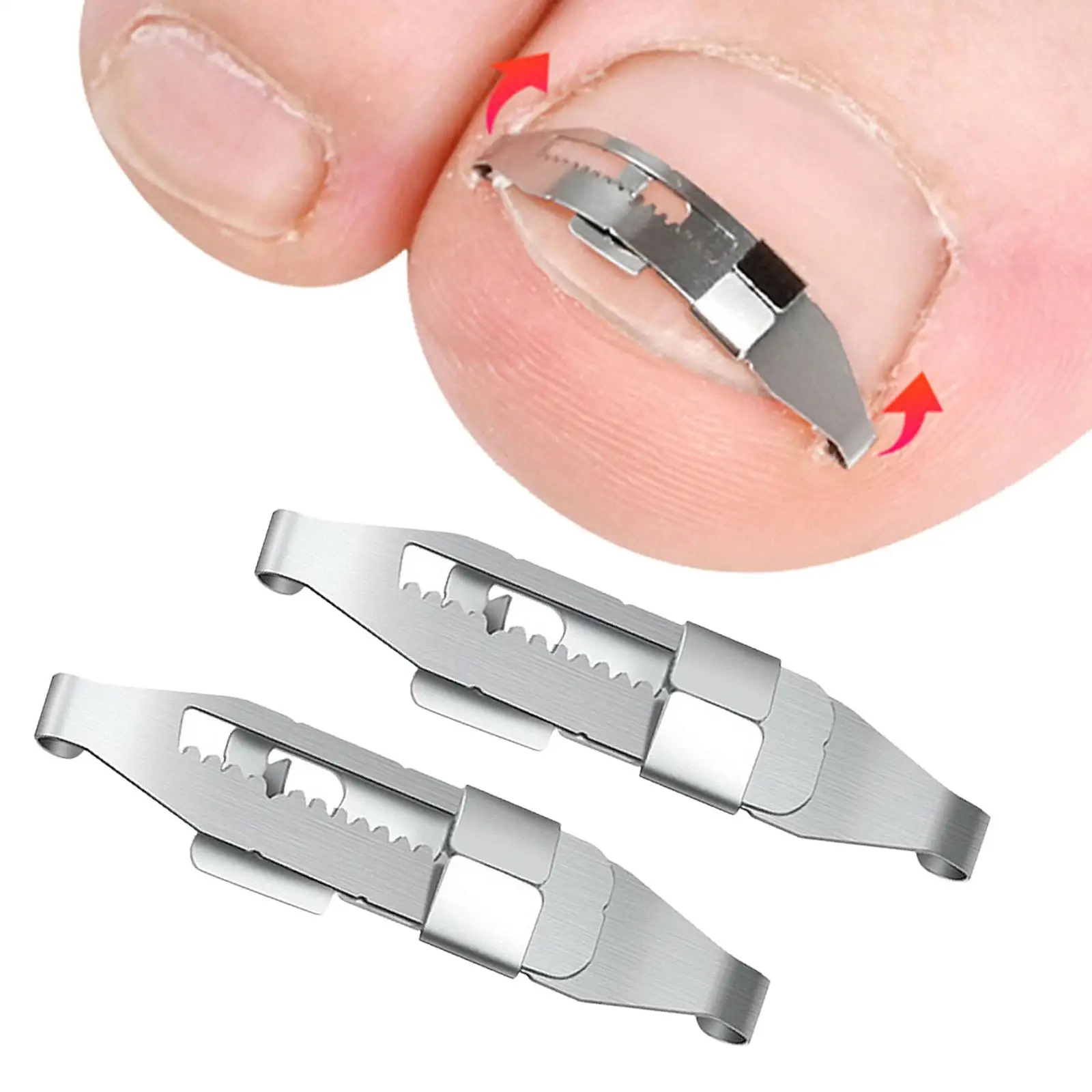 Professional Ingrown Toenail Corrector Tools Embed Toe Nails Treatment
