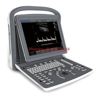 Chison ECO2 Portable B/W Ultrasound Scanner Machine Medical Imaging System Medical Ultrasound Instruments Price