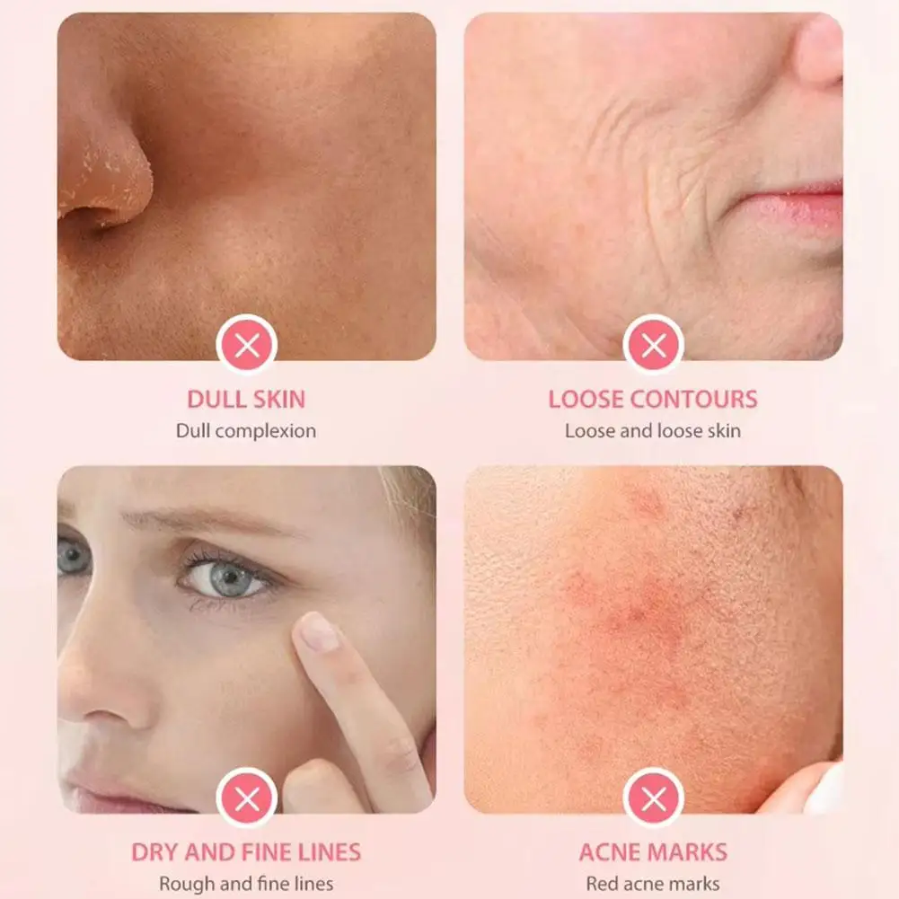 كريم ترطيب بروتين روز ايسنس كريم وجه مرطب غير دهني مهدئ لإصلاح كريم وجه للعناية بالبشرة