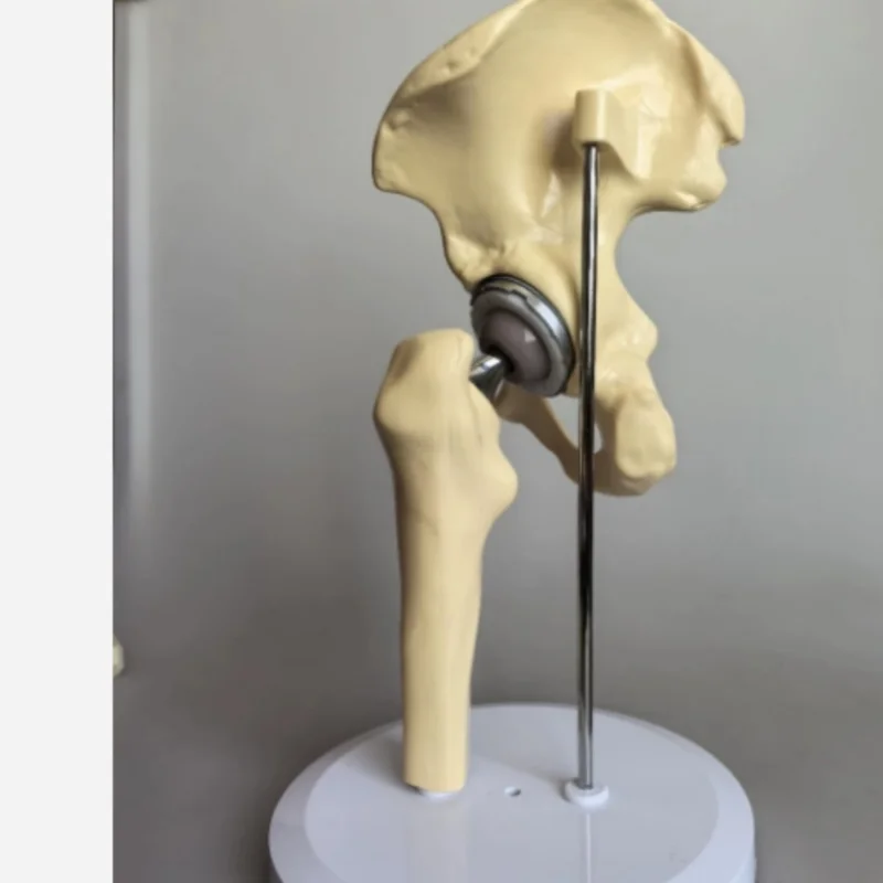 Artificial Hip Joint Model High Quality Medical Teaching Model Material: PVC ABS Plastic Electroplated Parts