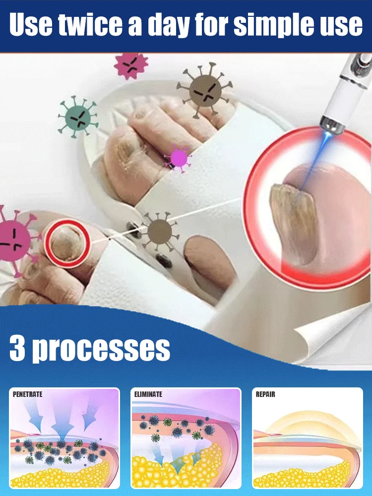 速攻浸透、爪が透明になり、真菌がなくなります。