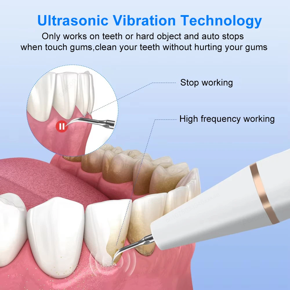 Détartreur dentaire à ultrasons, éliminateur de tartre des dents, nettoyeur de plaque dentaire, livres de taches de dents, détartreur, dissolvant de pierre