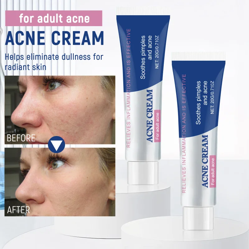 

Herbal Soothing Acne Cream Gentle Care Balances Oil Clarifies Skin Improves Breakouts Hydrating Moisturizing Nourishing Facial