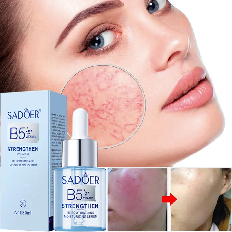 Facial Redness Repair Serum Improve Sensitive Muscles Acne Rosacea Dry&Itchy Skin Moisturizer Lotion Korean Skin Care products
