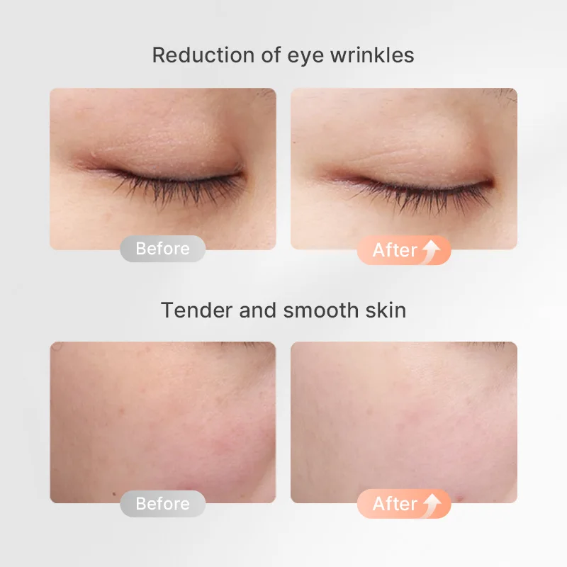 المكتبة الذكية TOUCHBeauty 3 في 1 جهاز تجميل الوجه الخفيف على شكل حرف V جهاز رفع الوجه والرقبة الكهربائية للعين و #4