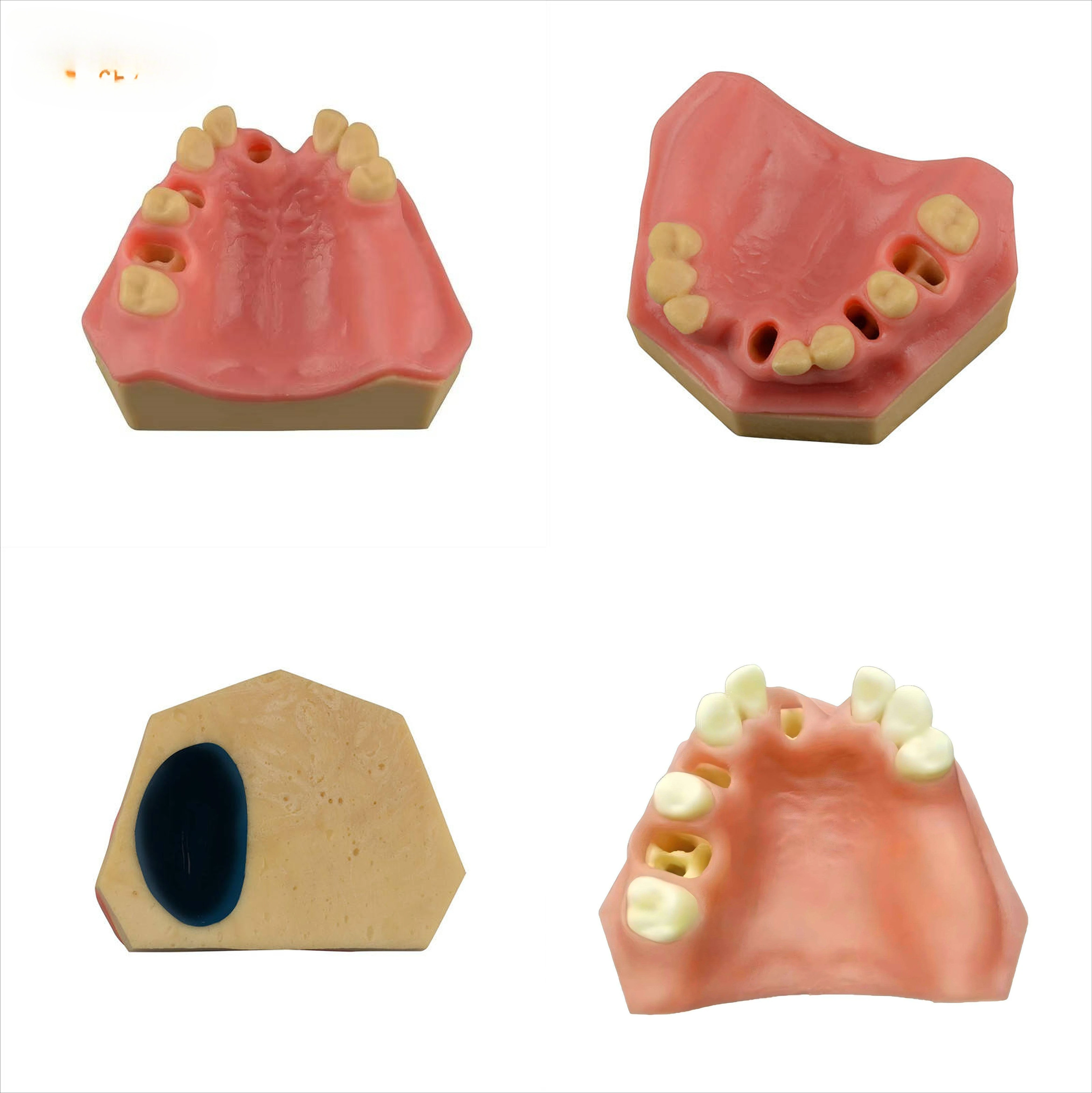 Dentals Tooth Preparation Practice Model Sinus Tooth Loss Simulation Oral Implants Training Medical Exam