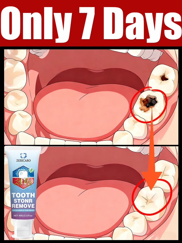 

Effortlessly Regenerate Gums & Cover Teeth in Just 7 Days