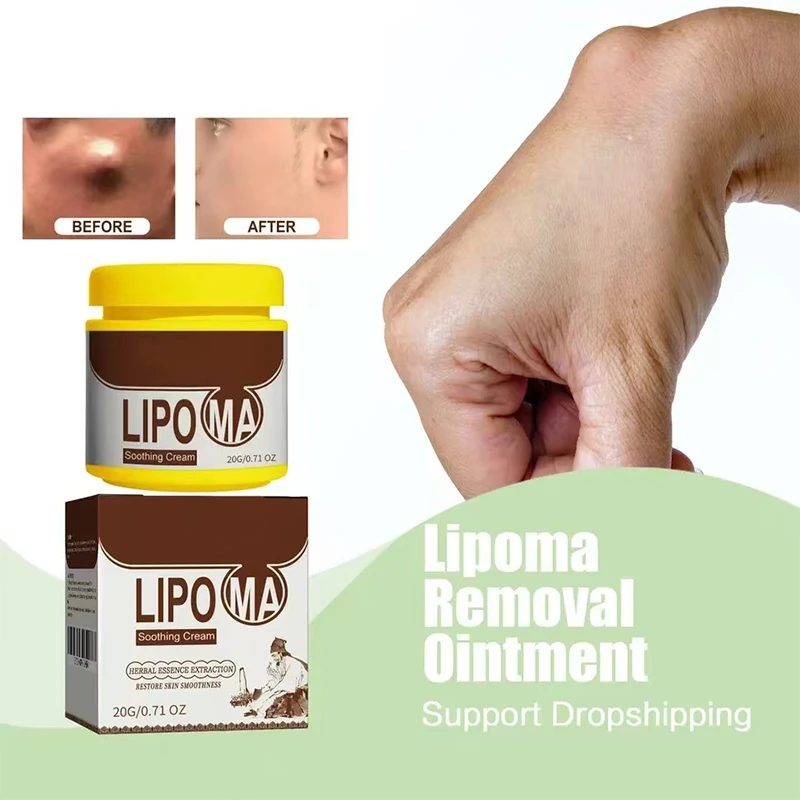 Crème Anti-Gonflage pour l'Élimination des Lipomes, 20g, Produit Organique à Proximité Lymphatique, Poignées de Bœuf, Traitement Efficace et Indolore des Seins, Nministériels ds Lymphatiques