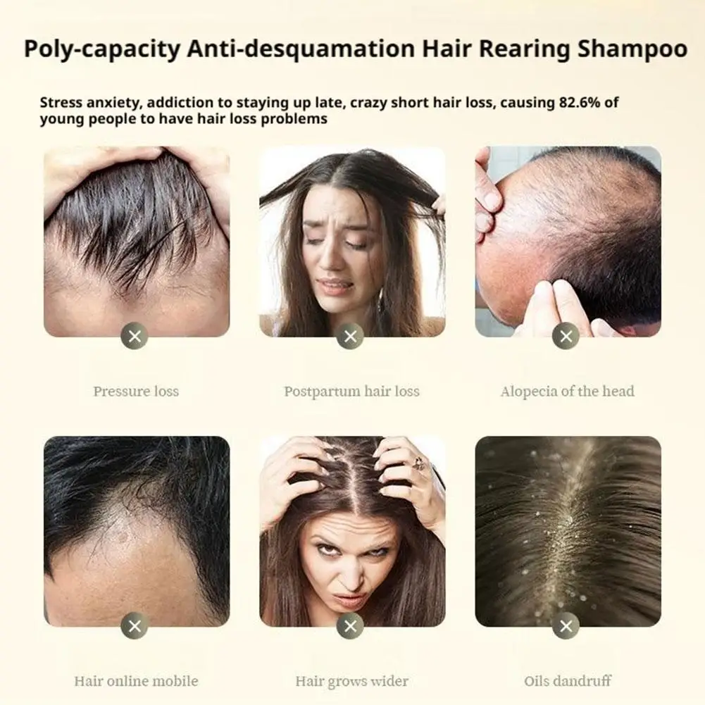 شامبو بوليغونوم مالتيفلوروم الزنجبيل المضاد لتساقط الشعر، تجديد سريع للشعر، مضاد للقشرة، شامبو للتحكم في الزيت 200 جرام